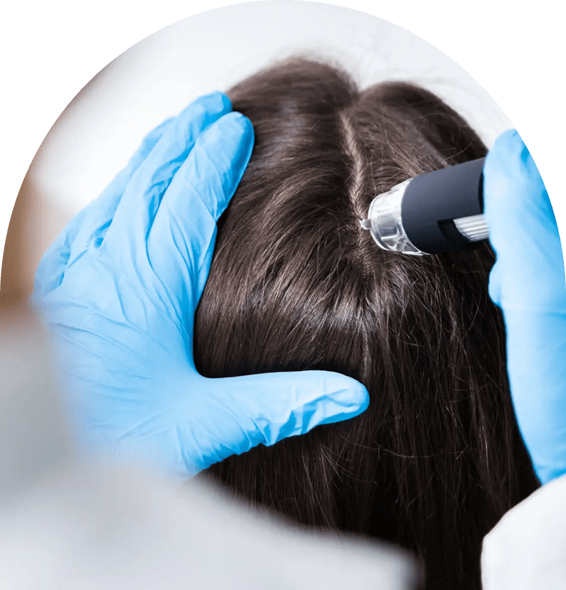 Close-up scalp examination with dermatoscope